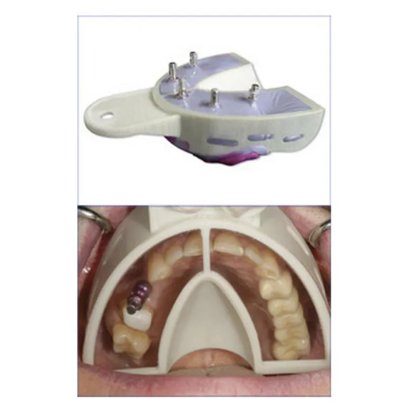 CUBETAS MIRATRAY IMPLANT INFERIOR MEDIANA
